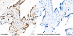 Phospho-ATR (Ser428) Antibody in Immunohistochemistry (Paraffin) (IHC (P))