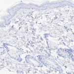 TRPV1 Antibody in Immunohistochemistry (Paraffin) (IHC (P))