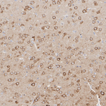 IP3 Receptor 1 Recombinant Mouse Monoclonal Antibody (PSH14-18)