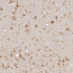IP3 Receptor 1 Antibody in Immunohistochemistry (Paraffin) (IHC (P))