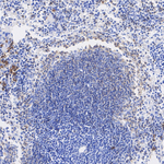 CD25 Antibody in Immunohistochemistry (Paraffin) (IHC (P))
