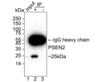 PSEN2 Antibody in Immunoprecipitation (IP)