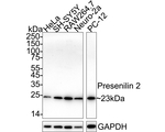 PSEN2 Antibody in Western Blot (WB)