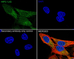 HIP2 Antibody in Immunocytochemistry (ICC/IF)