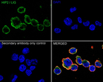 HIP2 Antibody in Immunocytochemistry (ICC/IF)
