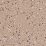 HIP2 Antibody in Immunohistochemistry (Paraffin) (IHC (P))