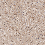 HIP2 Antibody in Immunohistochemistry (Paraffin) (IHC (P))