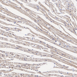 HIP2 Antibody in Immunohistochemistry (Paraffin) (IHC (P))