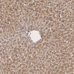 HIP2 Antibody in Immunohistochemistry (Paraffin) (IHC (P))