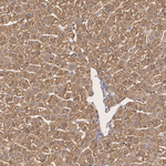 HIP2 Antibody in Immunohistochemistry (Paraffin) (IHC (P))