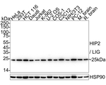 HIP2 Antibody in Western Blot (WB)