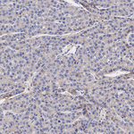 SMOC2 Recombinant Rabbit Monoclonal Antibody (PSH11-25)