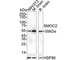 SMOC2 Antibody in Western Blot (WB)
