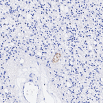 LPA Antibody in Immunohistochemistry (Paraffin) (IHC (P))