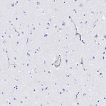 LPA Recombinant Rabbit Monoclonal Antibody (PSH11-29)