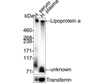LPA Antibody in Western Blot (WB)