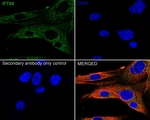 IFT88 Antibody in Immunocytochemistry (ICC/IF)