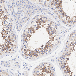 IFT88 Antibody in Immunohistochemistry (Paraffin) (IHC (P))