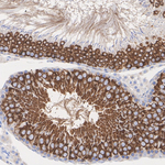 IFT88 Antibody in Immunohistochemistry (Paraffin) (IHC (P))