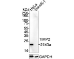TIMP2 Antibody in Western Blot (WB)