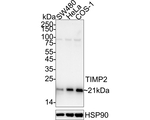 TIMP2 Recombinant Rabbit Monoclonal Antibody (PSH11-62)