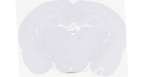 AVP Antibody in Immunohistochemistry (Paraffin) (IHC (P))