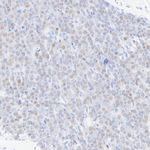 POU4F1 Antibody in Immunohistochemistry (Paraffin) (IHC (P))