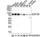 EEF2K Antibody in Western Blot (WB)