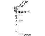EEF2K Antibody in Western Blot (WB)