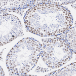 CHD8 Antibody in Immunohistochemistry (Paraffin) (IHC (P))