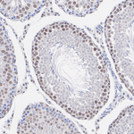 CHD8 Antibody in Immunohistochemistry (Paraffin) (IHC (P))