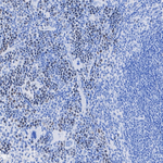 Survivin Antibody in Immunohistochemistry (Paraffin) (IHC (P))