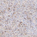 AFP Antibody in Immunohistochemistry (Paraffin) (IHC (P))