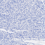 AFP Antibody in Immunohistochemistry (Paraffin) (IHC (P))