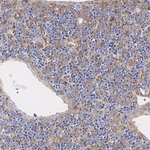 AFP Antibody in Immunohistochemistry (Paraffin) (IHC (P))