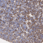AFP Antibody in Immunohistochemistry (Paraffin) (IHC (P))