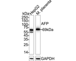 AFP Antibody in Western Blot (WB)