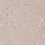 MAP2K4 Antibody in Immunohistochemistry (Paraffin) (IHC (P))