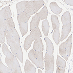 MAP2K4 Recombinant Rabbit Monoclonal Antibody (PSH11-99)