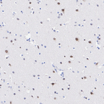 SMARCC2 Antibody in Immunohistochemistry (Paraffin) (IHC (P))