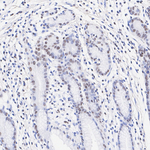 SMARCC2 Antibody in Immunohistochemistry (Paraffin) (IHC (P))