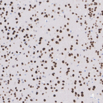 SMARCC2 Antibody in Immunohistochemistry (Paraffin) (IHC (P))