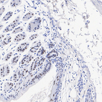 SMARCC2 Antibody in Immunohistochemistry (Paraffin) (IHC (P))