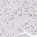SMARCC2 Antibody in Immunohistochemistry (Paraffin) (IHC (P))