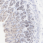 SMARCC2 Antibody in Immunohistochemistry (Paraffin) (IHC (P))