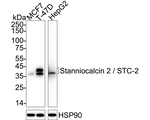 STC2 Antibody in Western Blot (WB)