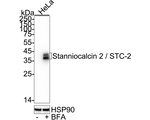 STC2 Antibody in Western Blot (WB)