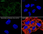 LARP1 Antibody in Immunocytochemistry (ICC/IF)