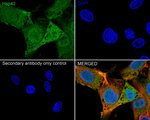 HSP40 Antibody in Immunocytochemistry (ICC/IF)
