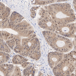 HSP40 Antibody in Immunohistochemistry (Paraffin) (IHC (P))
